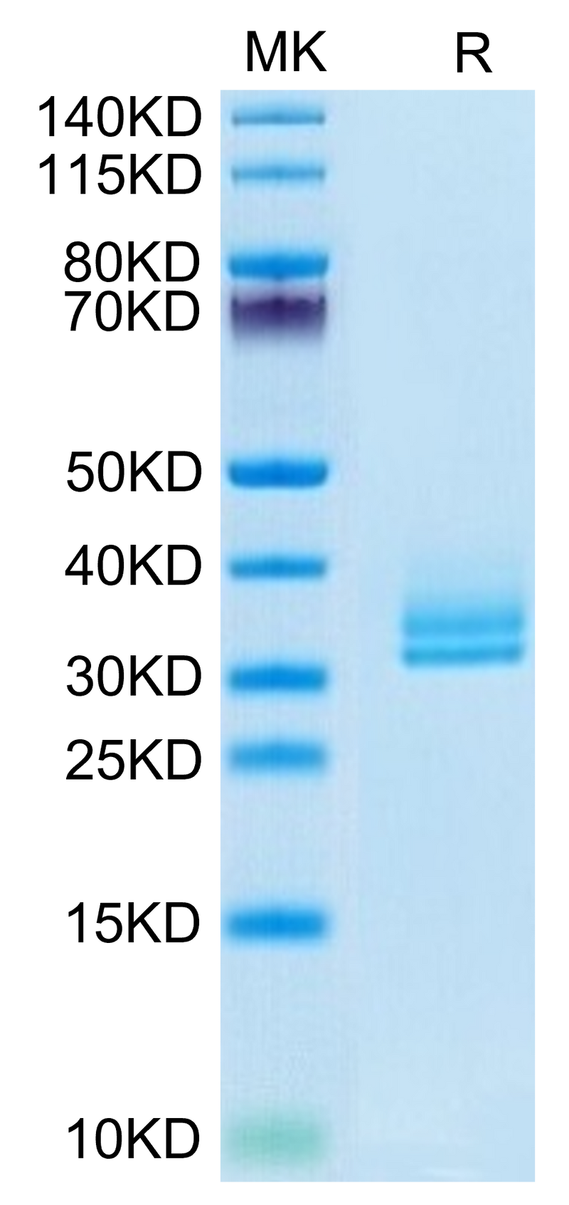 Biotinylated Human ANGPTL2 on Tris-Bis PAGE under reduced condition. The purity is greater than 95%.