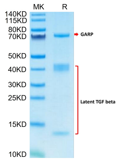 Human GARP (Y137H) &Latent TGF Beta 1 Complex on Tris-Bis PAGE under reduced condition. The purity is greater than 95%.