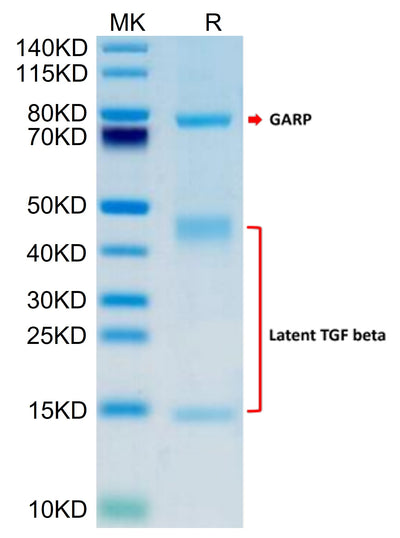 Human GARP (S138G) &Latent TGF Beta 1 Complex on Tris-Bis PAGE under reduced condition. The purity is greater than 95%.