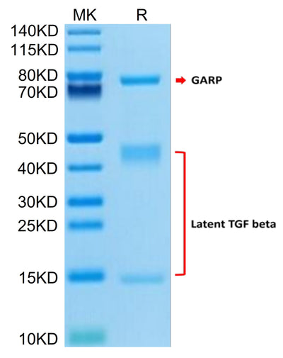 Human GARP (G139N) &Latent TGF Beta 1 Complex on Tris-Bis PAGE under reduced condition. The purity is greater than 95%.