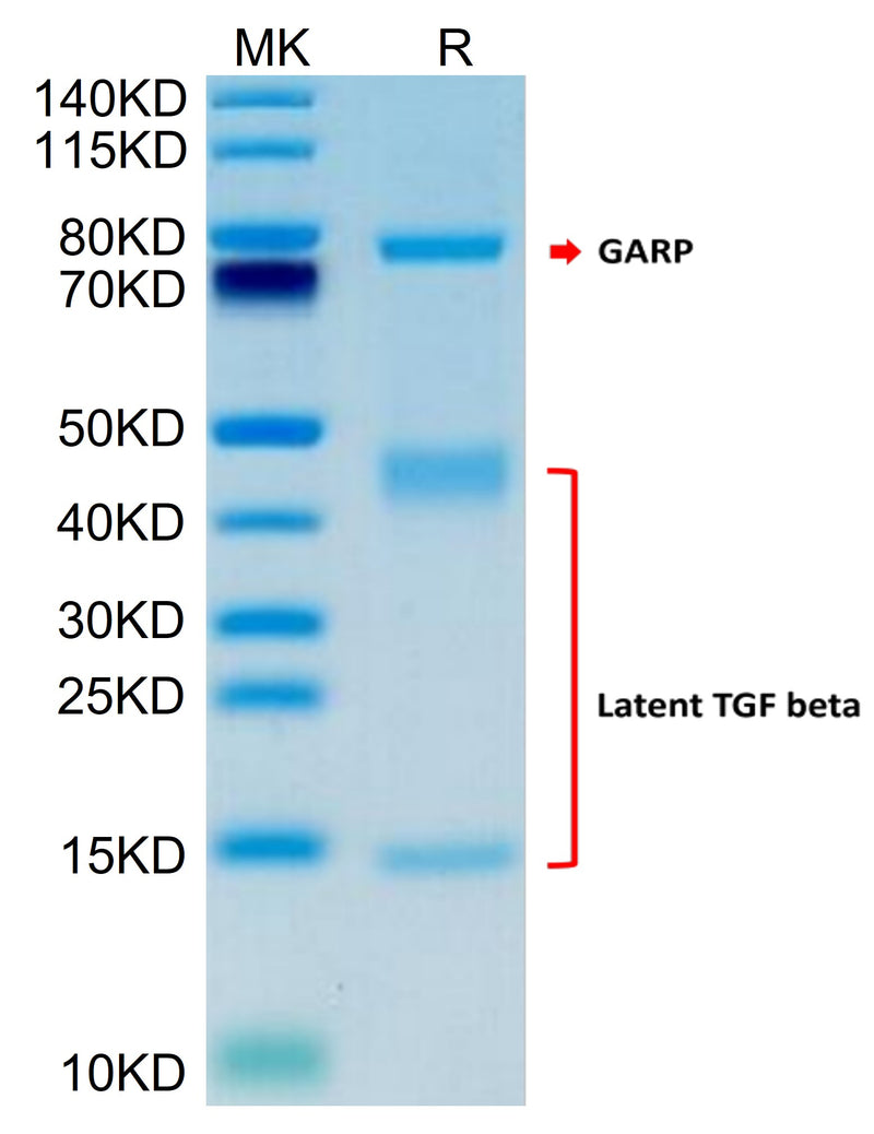 Human GARP (Y137H&S138G&G139N) &Latent TGF Beta 1 Complex on Tris-Bis PAGE under reduced condition. The purity is greater than 95%.