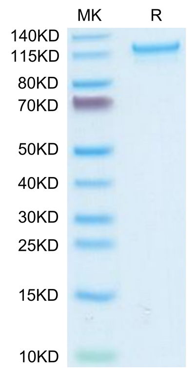 Human CD93 on Tris-Bis PAGE under reduced condition. The purity is greater than 95%.