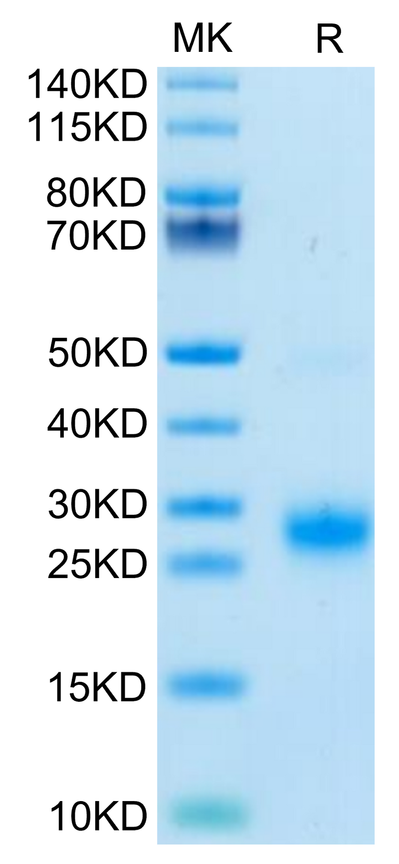 Biotinylated Human GITR on Tris-Bis PAGE under reduced condition. The purity is greater than 95%.