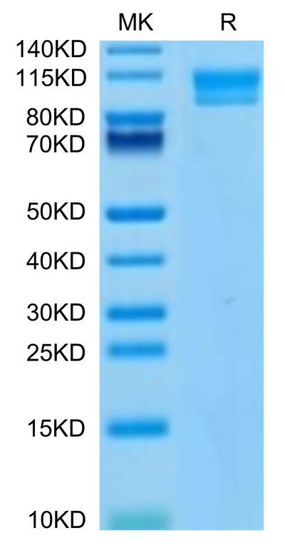 Human IL-17Rc on Tris-Bis PAGE under reduced condition. The purity is greater than 95%.