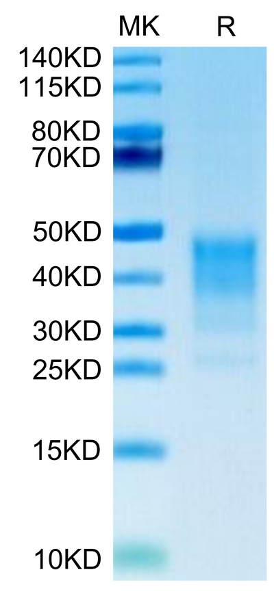 Human CD30 Ligand on Tris-Bis PAGE under reduced condition. The purity is greater than 95%.