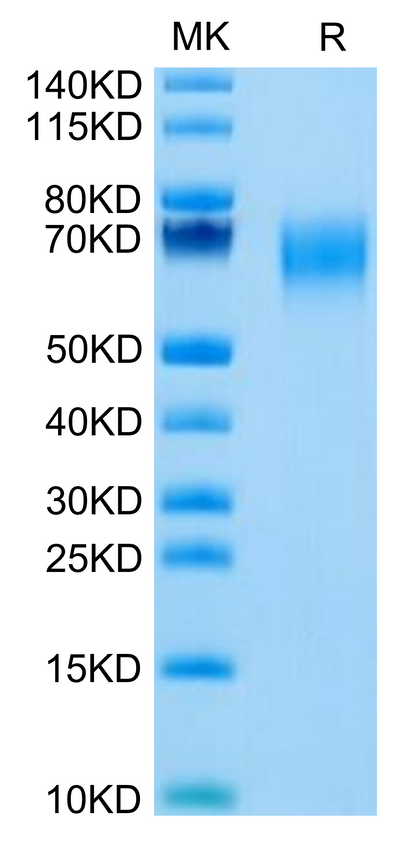 Cynomolgus IL-1 Rrp2/IL-1 R6 on Tris-Bis PAGE under reduced condition. The purity is greater than 95%.