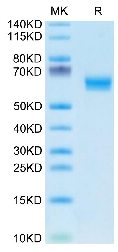 Human DDR1 on Tris-Bis PAGE under reduced condition. The purity is greater than 95%.