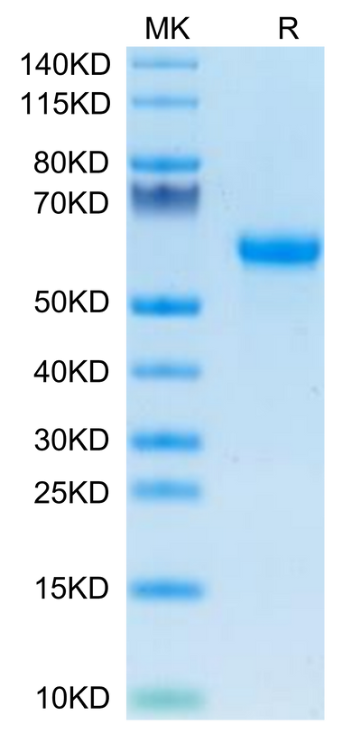 Mouse Factor H/CFH on Tris-Bis PAGE under reduced condition. The purity is greater than 95%.