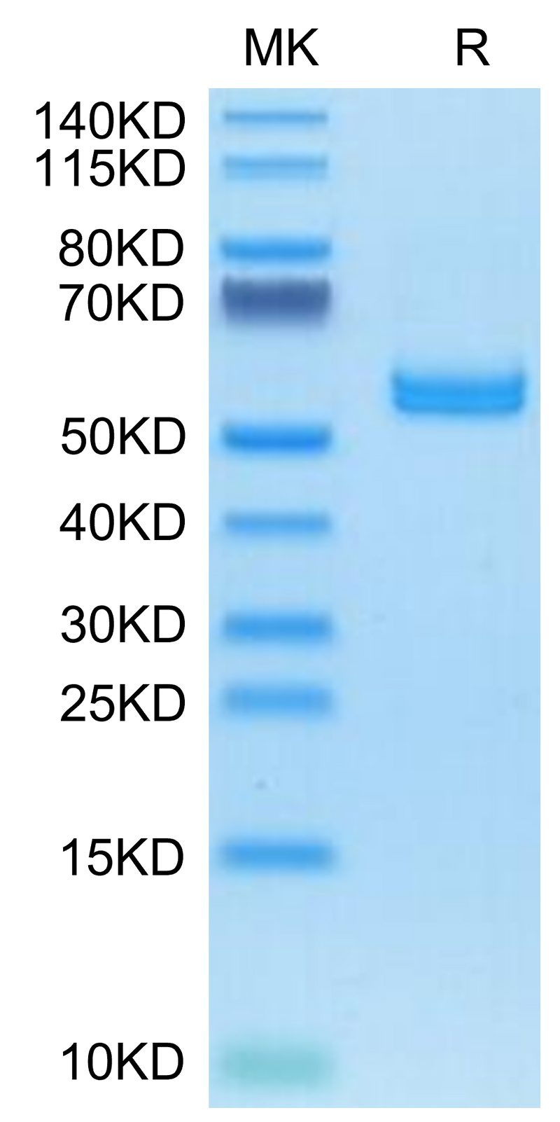 Human AMCase/CHIA on Tris-Bis PAGE under reduced condition. The purity is greater than 95%.