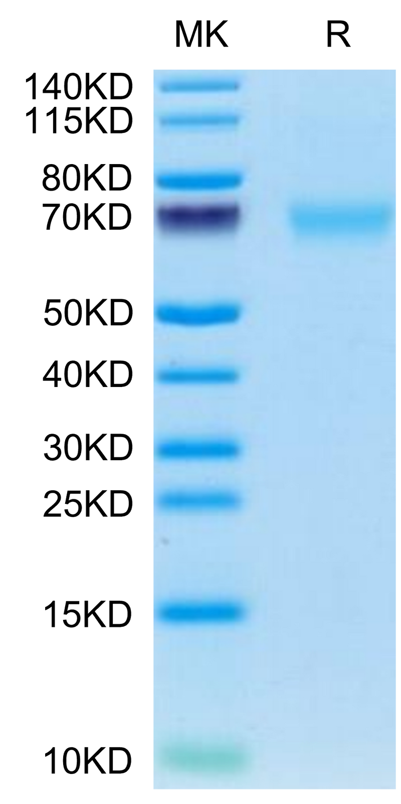 Cynomolgus AXL on Tris-Bis PAGE under reduced condition. The purity is greater than 95%.