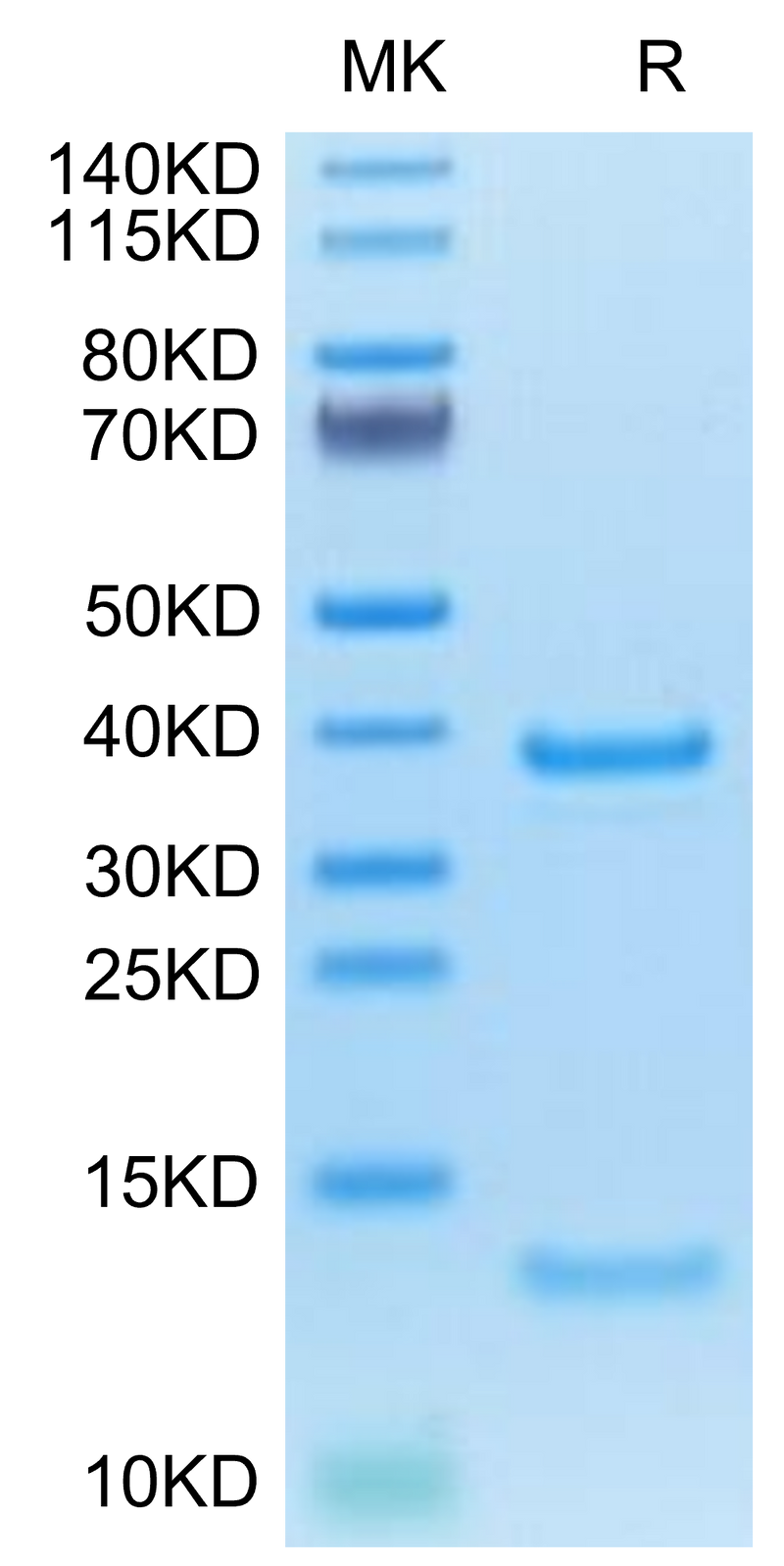 Cynomolgus/Rhesus macaque FcRn on Tris-Bis PAGE under reduced condition. The purity is greater than 95%.