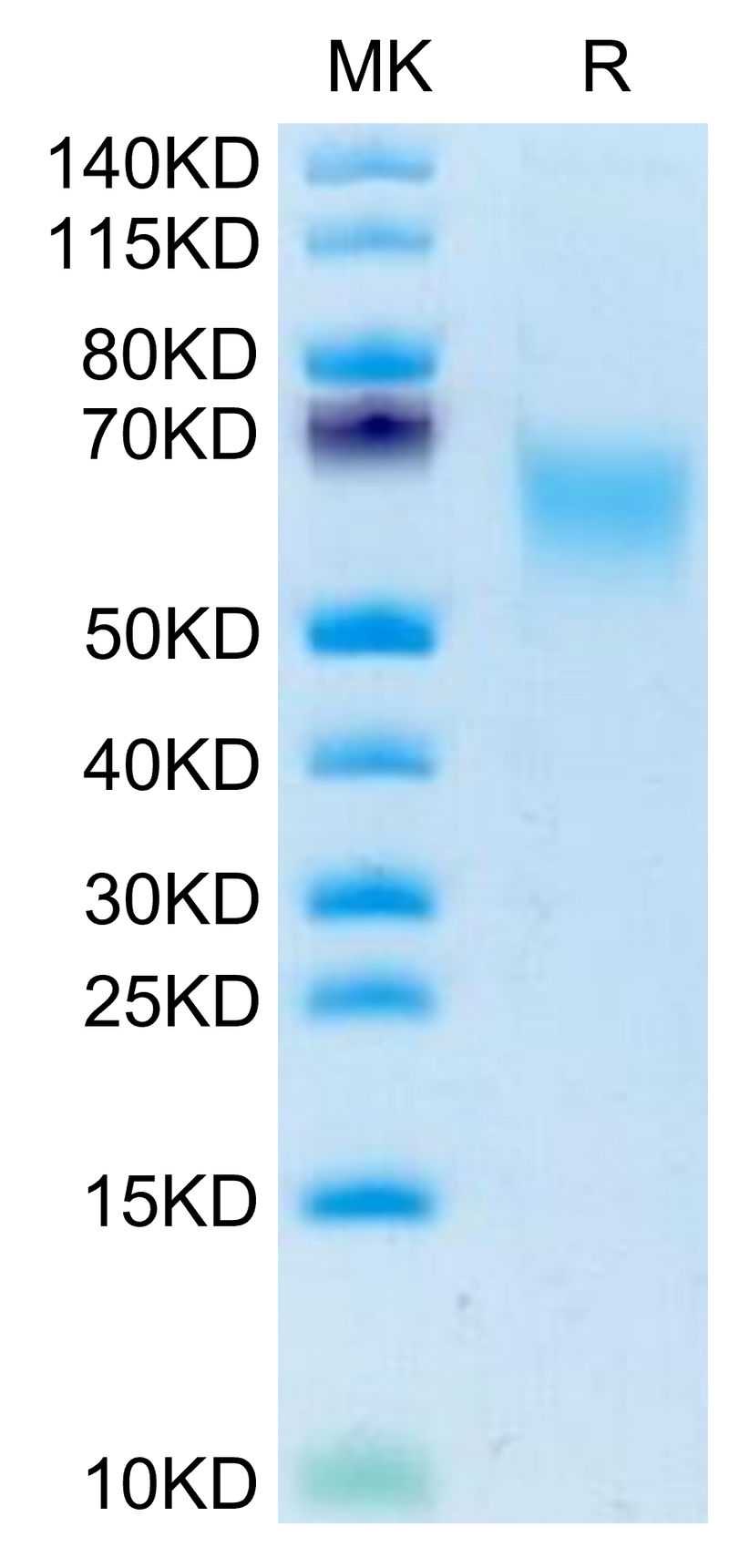 Human CADM1 on Tris-Bis PAGE under reduced condition. The purity is greater than 95%.