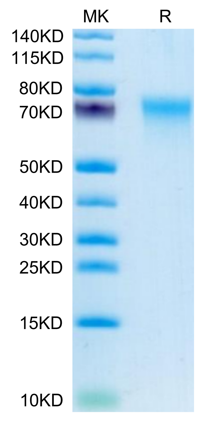 Human CD55 on Tris-Bis PAGE under reduced condition. The purity is greater than 95%.