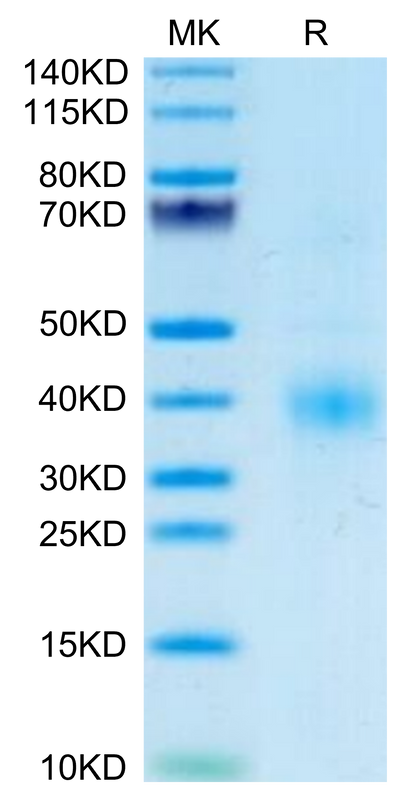 Human Clusterin on Tris-Bis PAGE under reduced condition. The purity is greater than 95%.