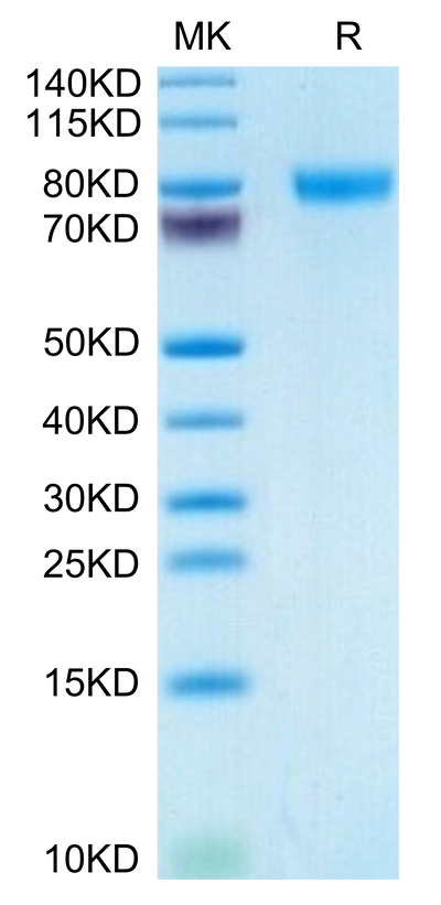 Human GEP on Tris-Bis PAGE under reduced condition. The purity is greater than 95%.