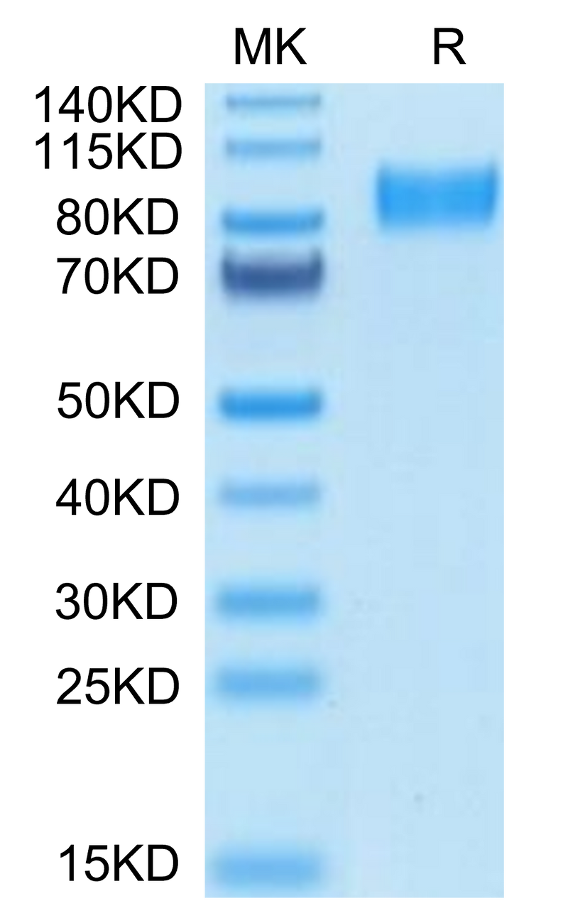 Mouse Osteoactivin on Tris-Bis PAGE under reduced condition. The purity is greater than 95%.