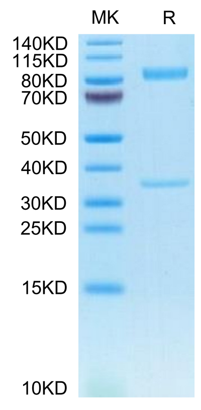 Human BACE-1 on Tris-Bis PAGE under reduced condition. The purity is greater than 95%.