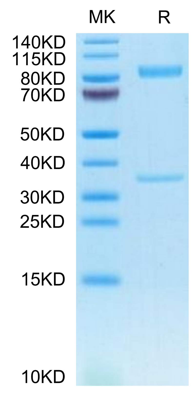 Human BACE-1 on Tris-Bis PAGE under reduced condition. The purity is greater than 95%.