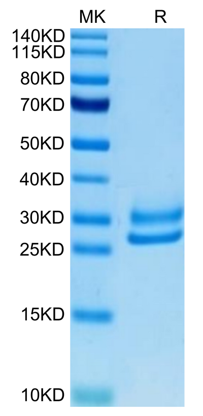 Human IL-15RA&IL-15 on Tris-Bis PAGE under reduced condition. The purity is greater than 95%.