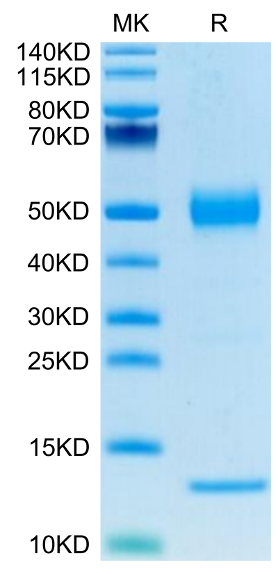 Human CD1A on Tris-Bis PAGE under reduced condition. The purity is greater than 95%.