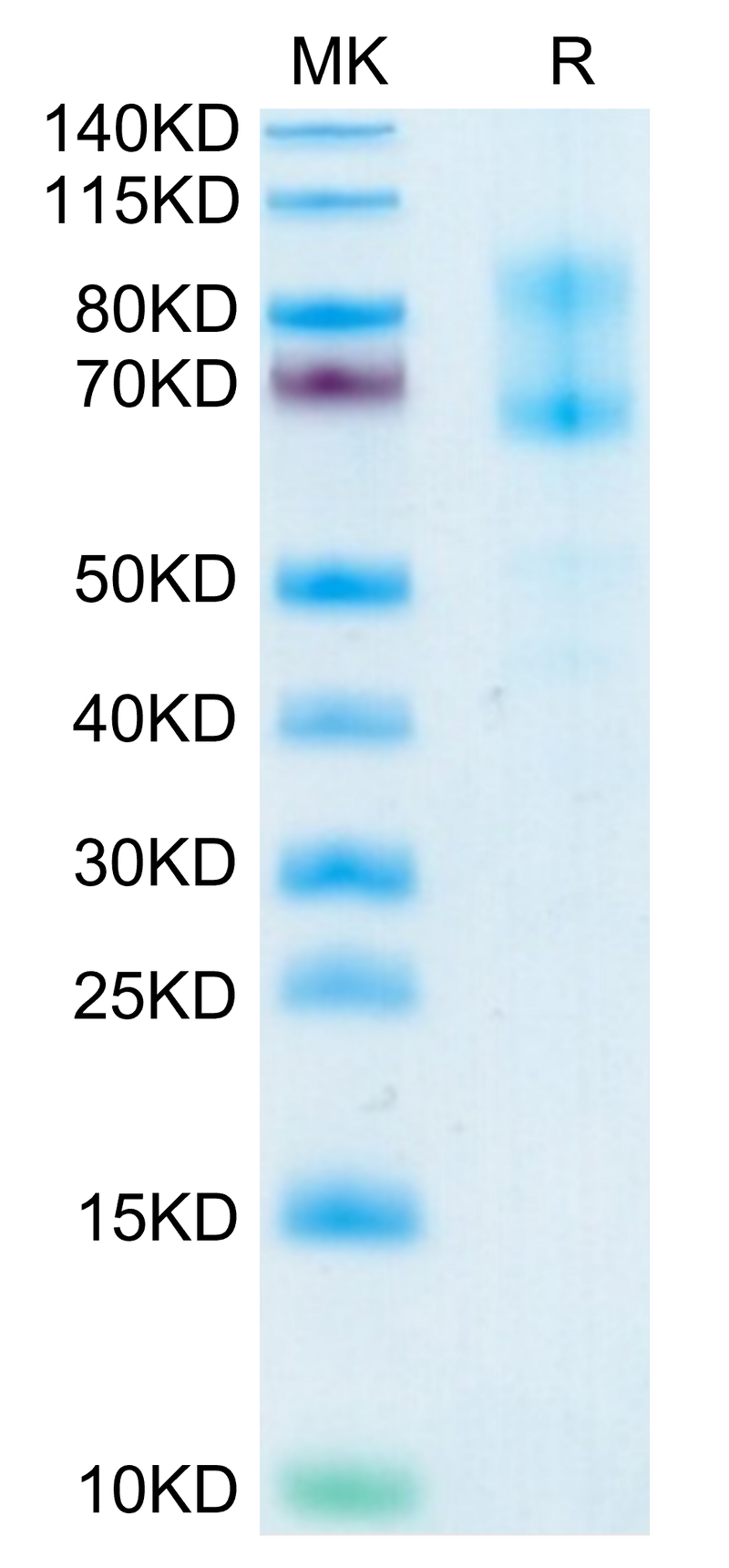 Human IL-2 R beta&IL-2 R gamma on Tris-Bis PAGE under reduced condition. The purity is greater than 95%.