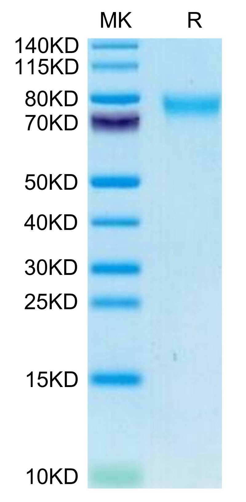 Canine GUCY2C/Guanylyl cyclase C on Tris-Bis PAGE under reduced condition. The purity is greater than 95%.