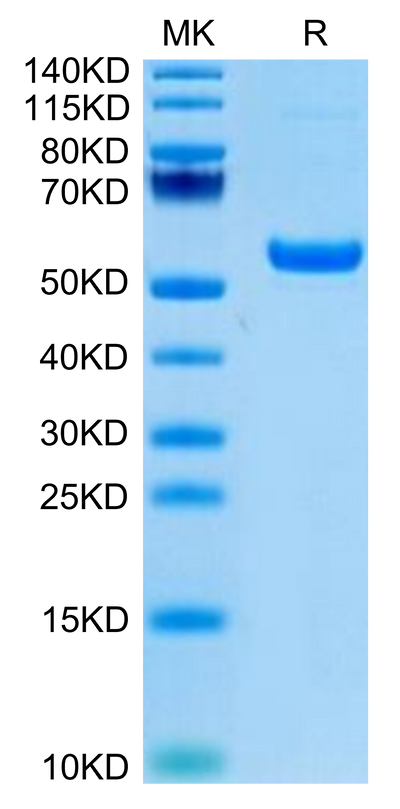 Rhesus macaque CD5 on Tris-Bis PAGE under reduced condition. The purity is greater than 95%.