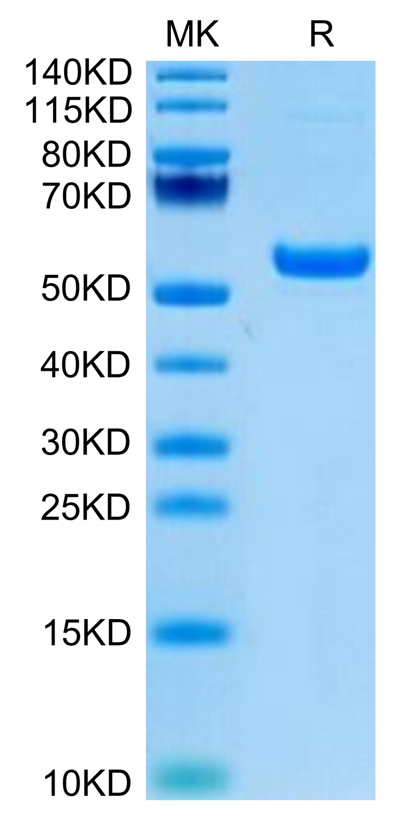 Rhesus macaque CD5 on Tris-Bis PAGE under reduced condition. The purity is greater than 95%.