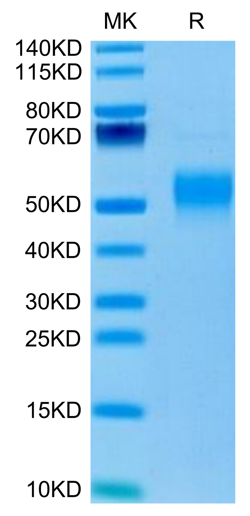 Mouse Fc gamma RI on Tris-Bis PAGE under reduced condition. The purity is greater than 95%.