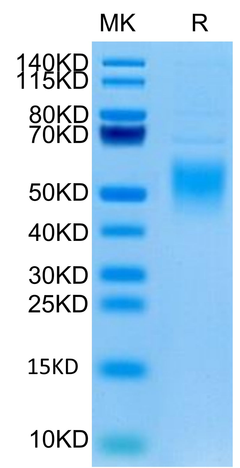 Human Fc epsilon RI alpha on Tris-Bis PAGE under reduced condition. The purity is greater than 95%.