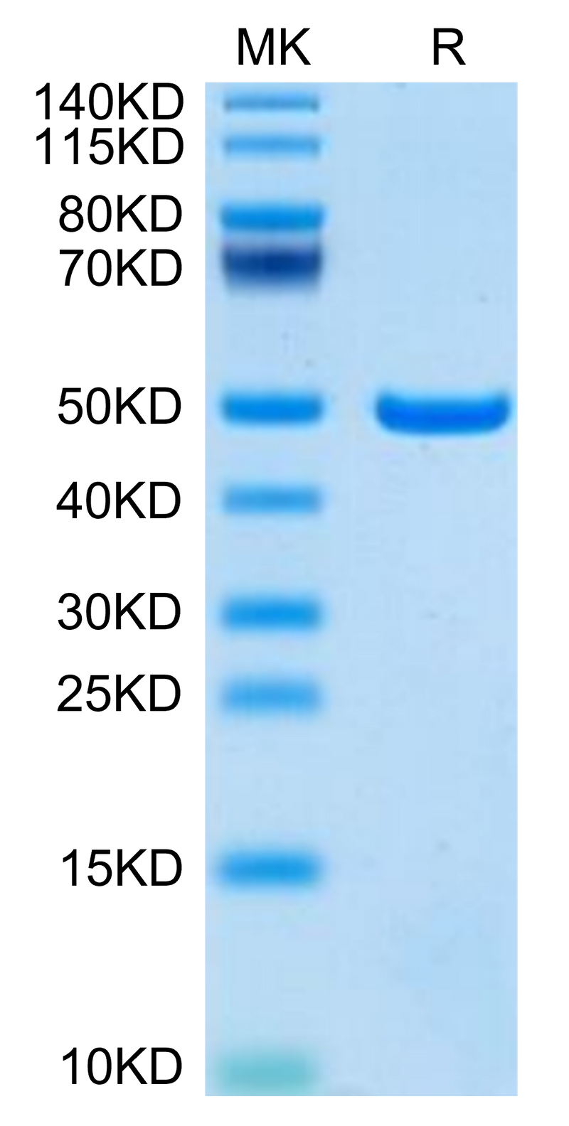 Mouse ASPH on Tris-Bis PAGE under reduced condition. The purity is greater than 95%.