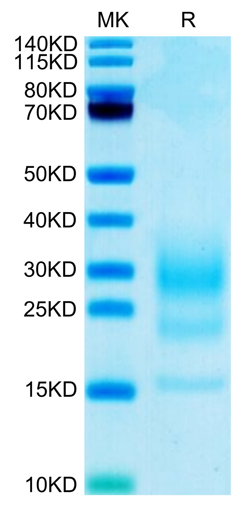 Biotinylated Mouse IL-5 on Tris-Bis PAGE under reduced condition. The purity is greater than 95%.