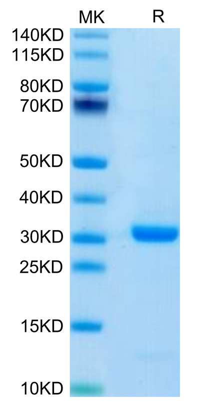 Human FOLR4 on Tris-Bis PAGE under reduced condition. The purity is greater than 95%.