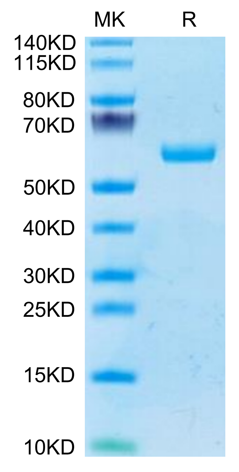 Human BTN3A1 on Tris-Bis PAGE under reduced condition. The purity is greater than 95%.