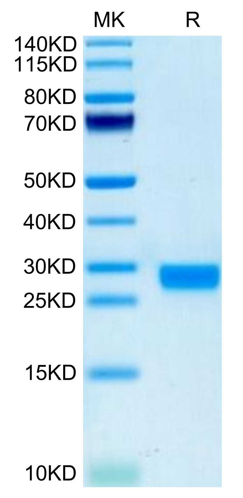 Biotinylated Mouse IL-2 on Tris-Bis PAGE under reduced condition. The purity is greater than 95%.