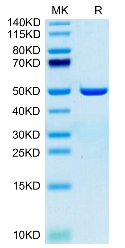 Human ASPH on Tris-Bis PAGE under reduced condition. The purity is greater than 95%.