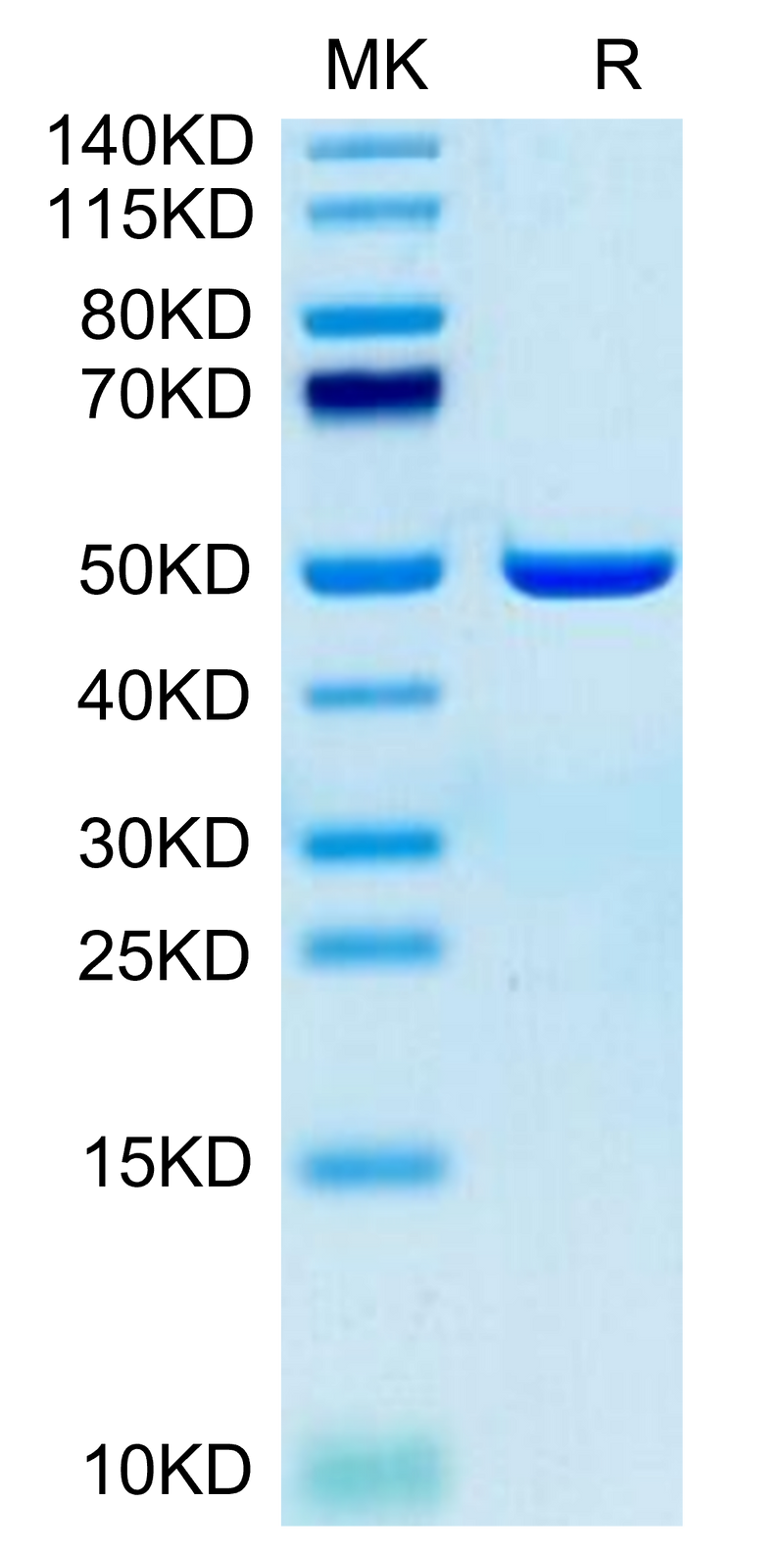 Human ASPH on Tris-Bis PAGE under reduced condition. The purity is greater than 95%.