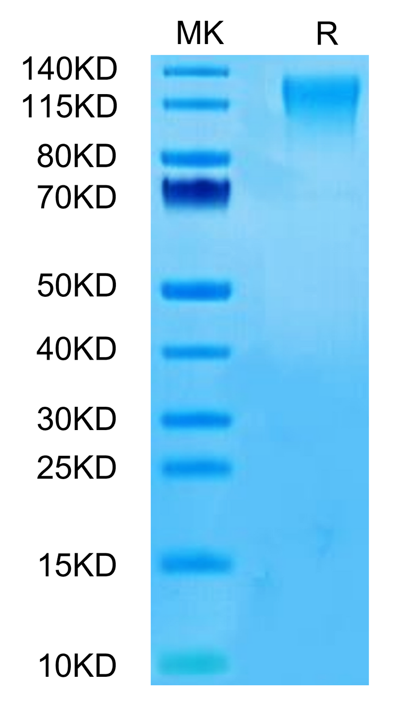 Human CD96 on Tris-Bis PAGE under reduced condition. The purity is greater than 95%.