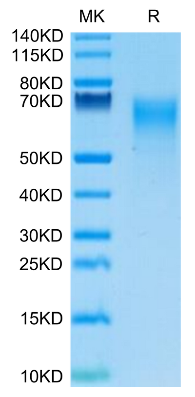 Human IL-17R alpha on Tris-Bis PAGE under reduced condition. The purity is greater than 95%.