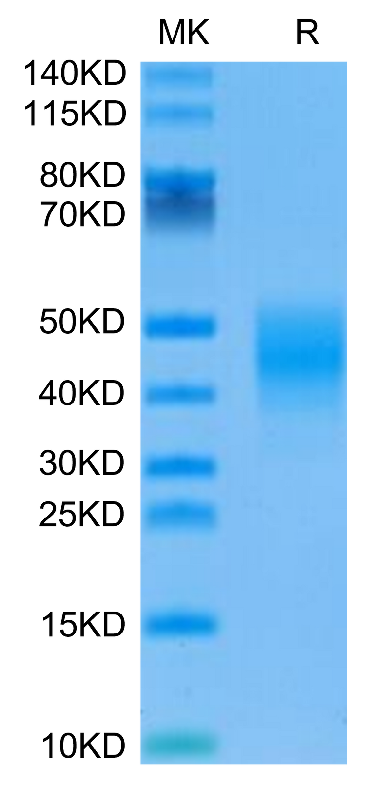 Mouse Fc gamma RIIB on Tris-Bis PAGE under reduced condition. The purity is greater than 95%.