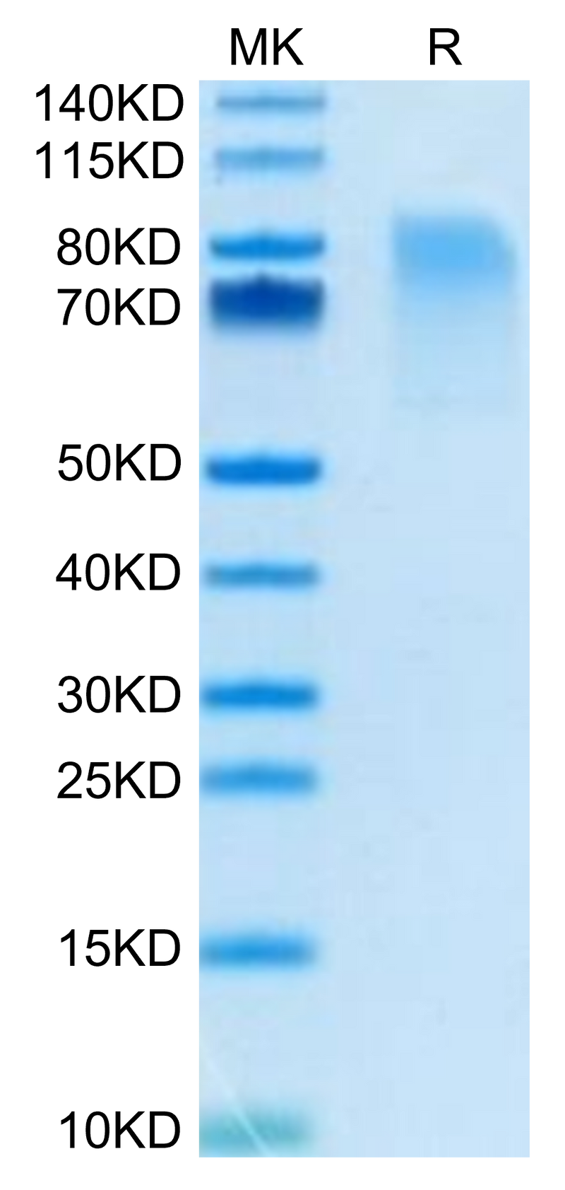 Biotinylated Mouse CX3CL1 on Tris-Bis PAGE under reduced condition. The purity is greater than 95%.