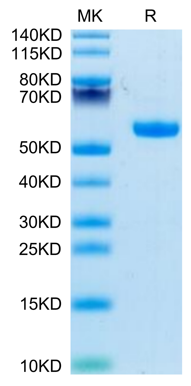 Biotinylated Rhesus macaque CD5 on Tris-Bis PAGE under reduced condition. The purity is greater than 95%.