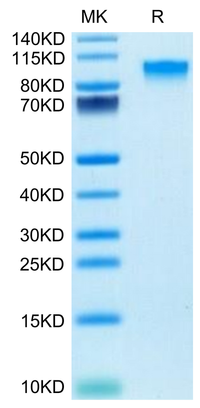 Mouse IL-17R alpha on Tris-Bis PAGE under reduced condition. The purity is greater than 95%.