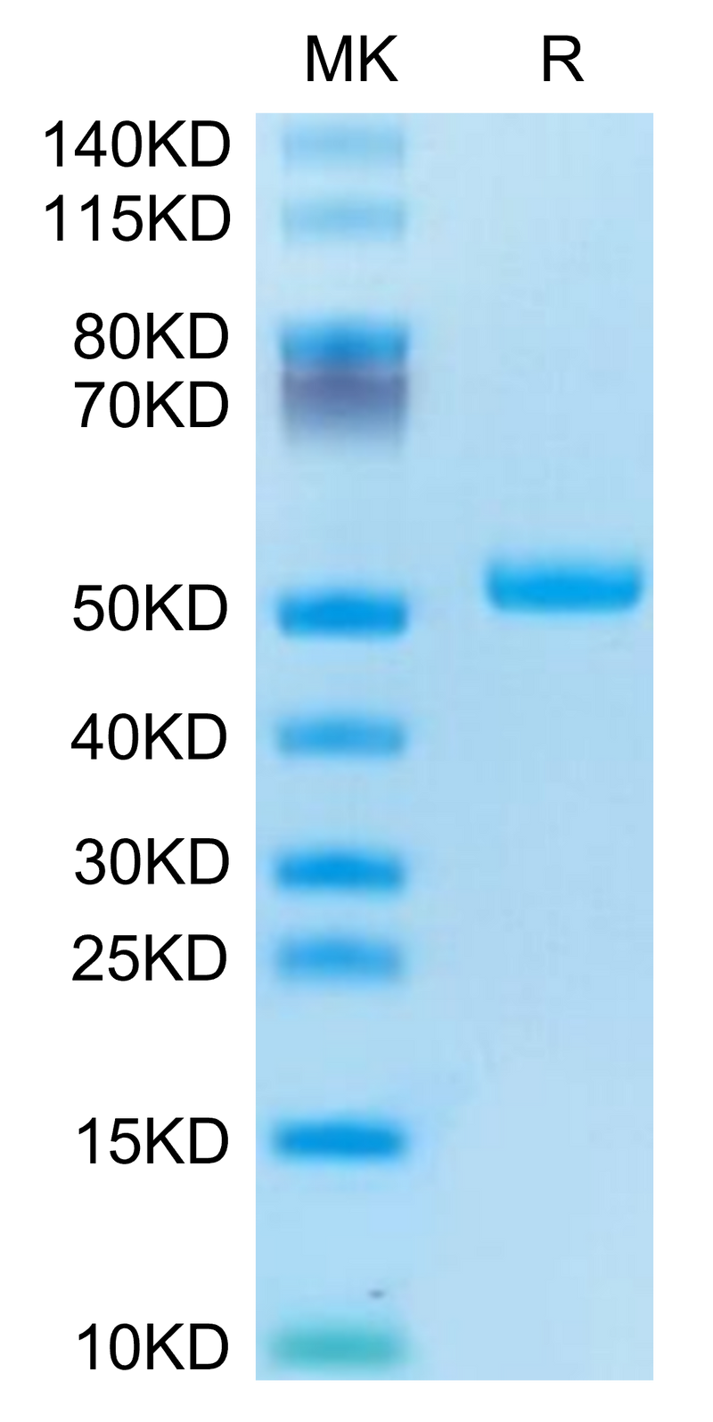 Human TRAIL R2 on Tris-Bis PAGE under reduced condition. The purity is greater than 95%.