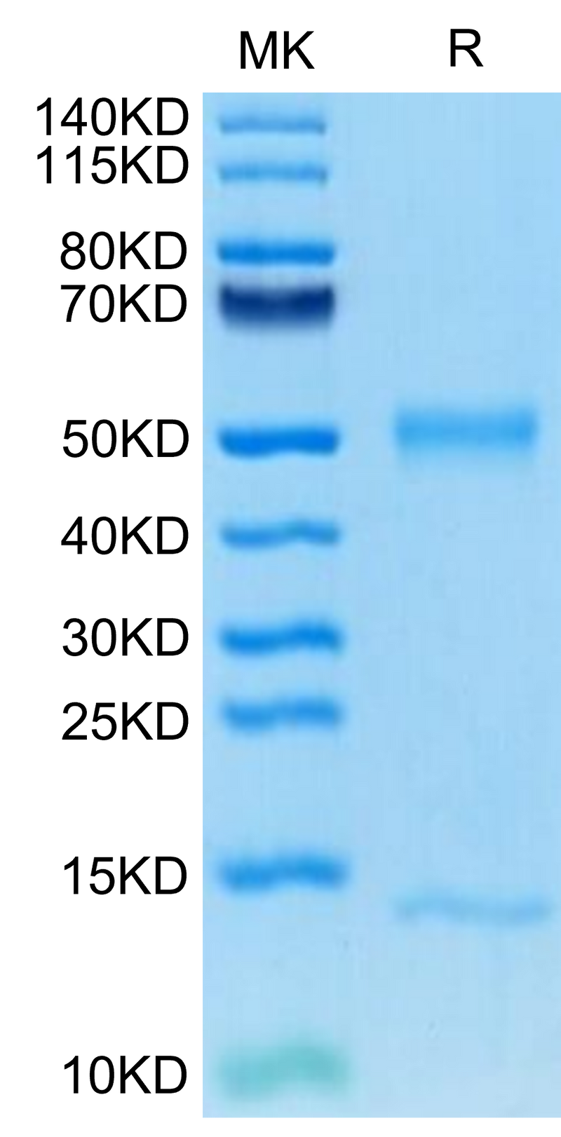 Mouse FcRn on Tris-Bis PAGE under reduced condition. The purity is greater than 95%.