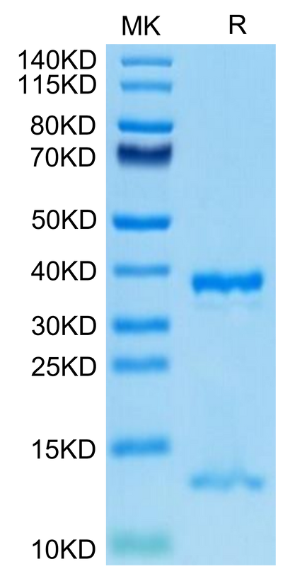 Human FcRn on Tris-Bis PAGE under reduced condition. The purity is greater than 95%.