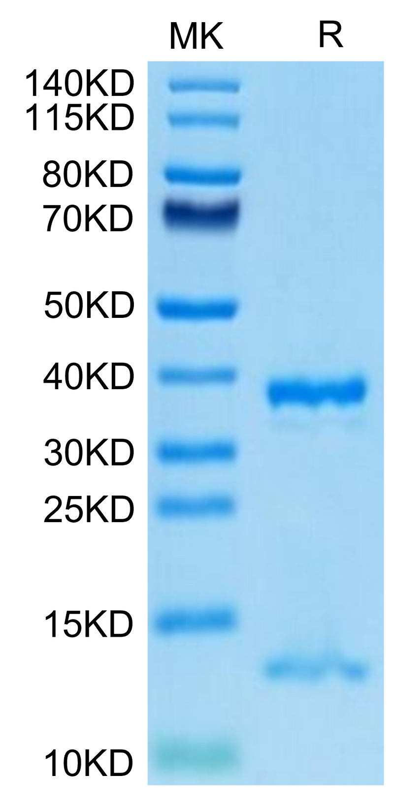 Human FcRn on Tris-Bis PAGE under reduced condition. The purity is greater than 95%.