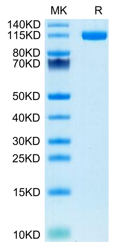 Human ENPP-1 on Tris-Bis PAGE under reduced condition. The purity is greater than 95%.