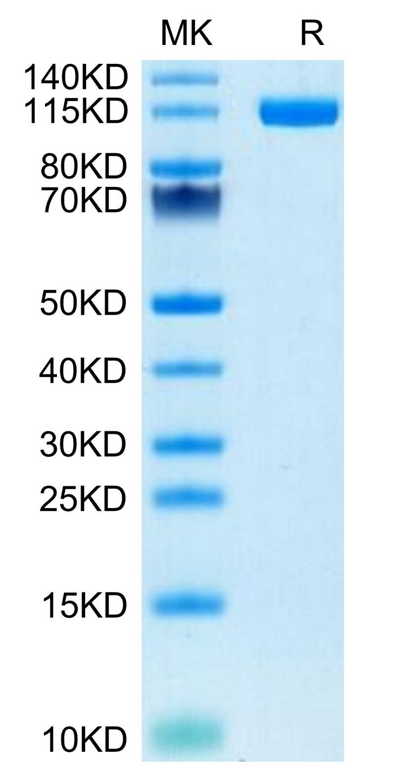 Human ENPP-1 on Tris-Bis PAGE under reduced condition. The purity is greater than 95%.