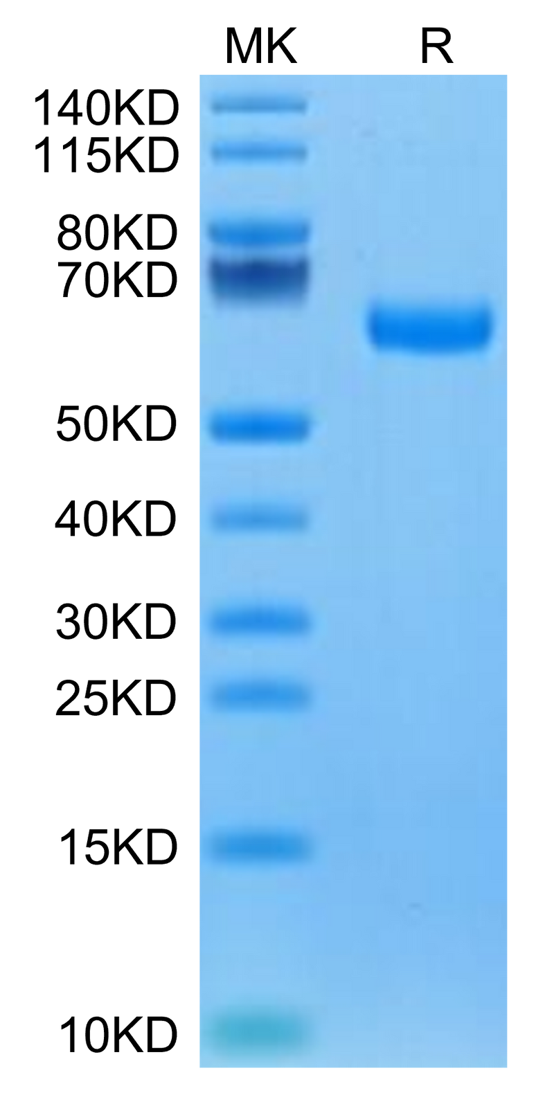 Canine ROR1 on Tris-Bis PAGE under reduced condition. The purity is greater than 95%.